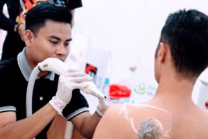 Kegiatan Hapus Tato, 2 Ribu Warga Sudah Mendaftar