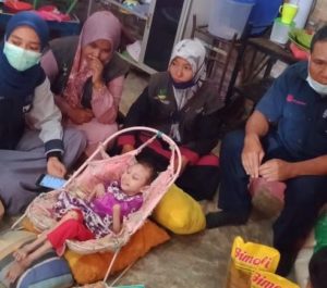 Gubernur Kirim Bantuan Stimulan untuk Bocah Pengidap Sindrom Selaput Otak di Tente, Bima